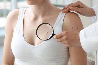 Doctor examining woman's mole with magnifying glass in clinic, closeup