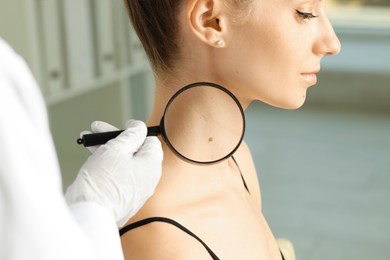 Doctor examining woman's mole with magnifying glass in clinic, closeup