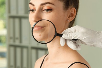 Doctor examining woman's mole with magnifying glass in clinic