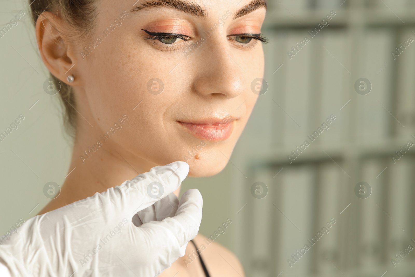 Photo of Doctor examining woman's mole in clinic, space for text