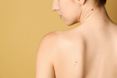 Woman with moles on her skin against beige background, back view. Space for text