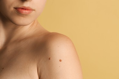 Woman with moles on her skin against beige background, closeup. Space for text