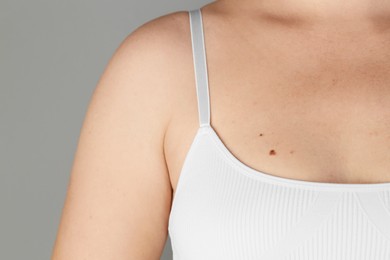 Woman with birthmarks on her skin against grey background, closeup