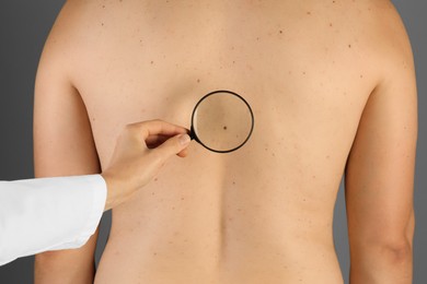 Dermatologist examining patient's birthmark with magnifying glass on grey background, closeup