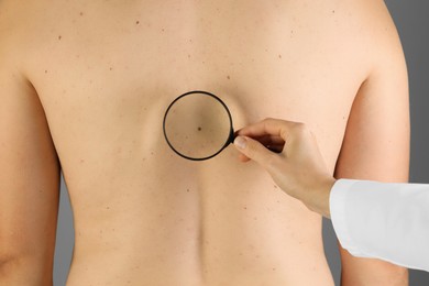 Photo of Dermatologist examining patient's birthmark with magnifying glass on grey background, closeup