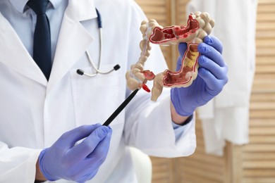 Photo of Doctor showing model of large intestine indoors, closeup