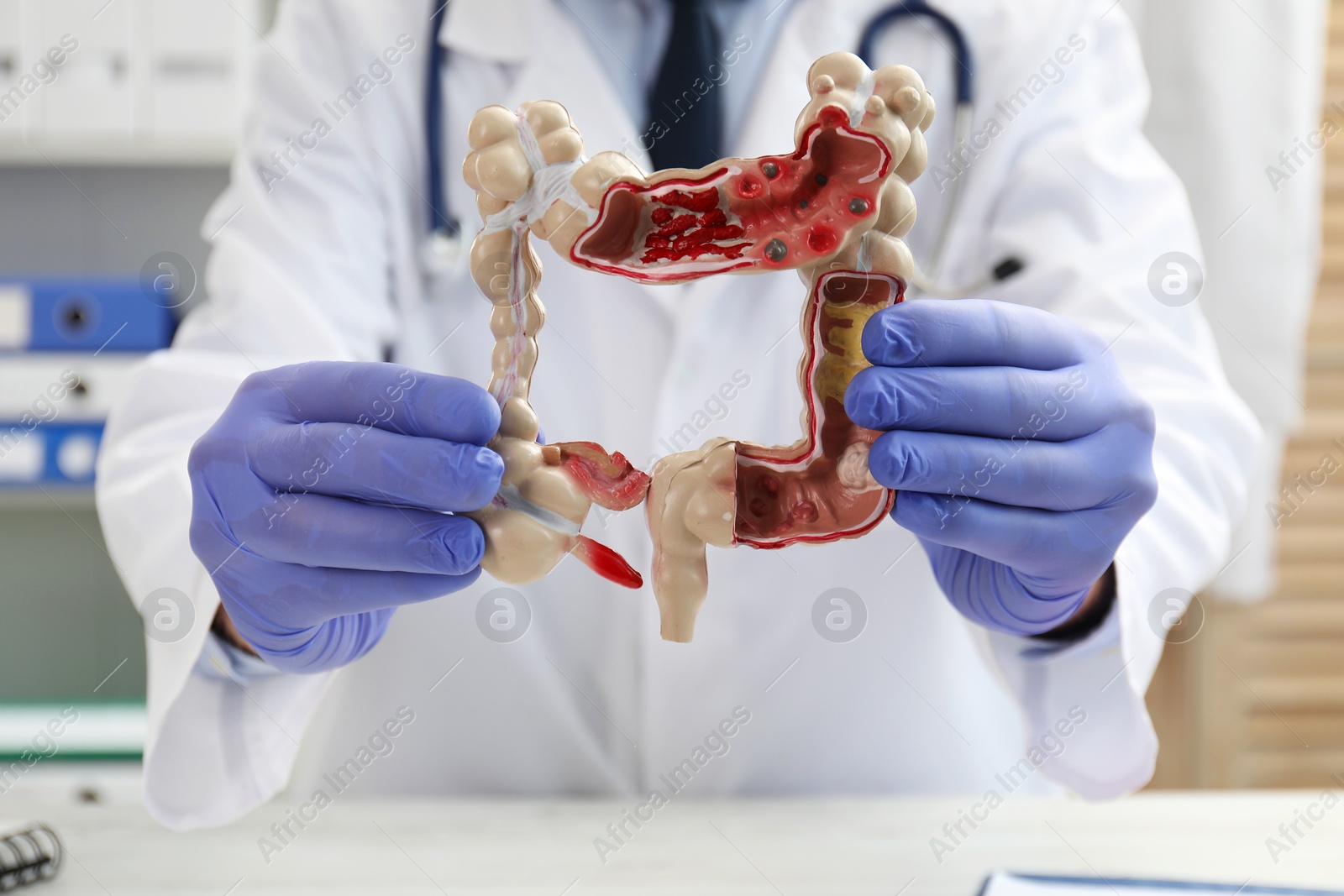 Photo of Doctor with model of large intestine at white table in clinic, selective focus