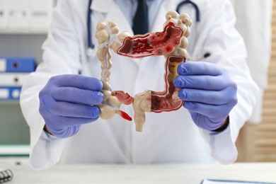 Photo of Doctor with model of large intestine at white table in clinic, selective focus