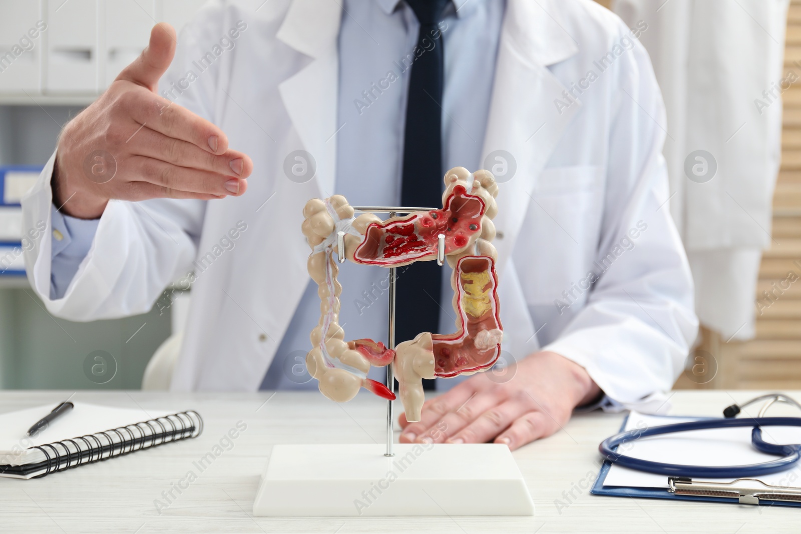 Photo of Doctor showing model of large intestine at white wooden table in clinic, closeup