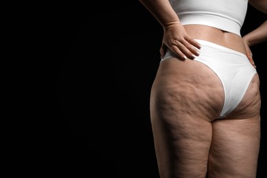 Woman with cellulite on black background, closeup. Space for text