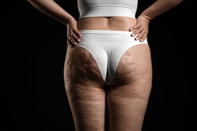 Woman with cellulite on black background, closeup