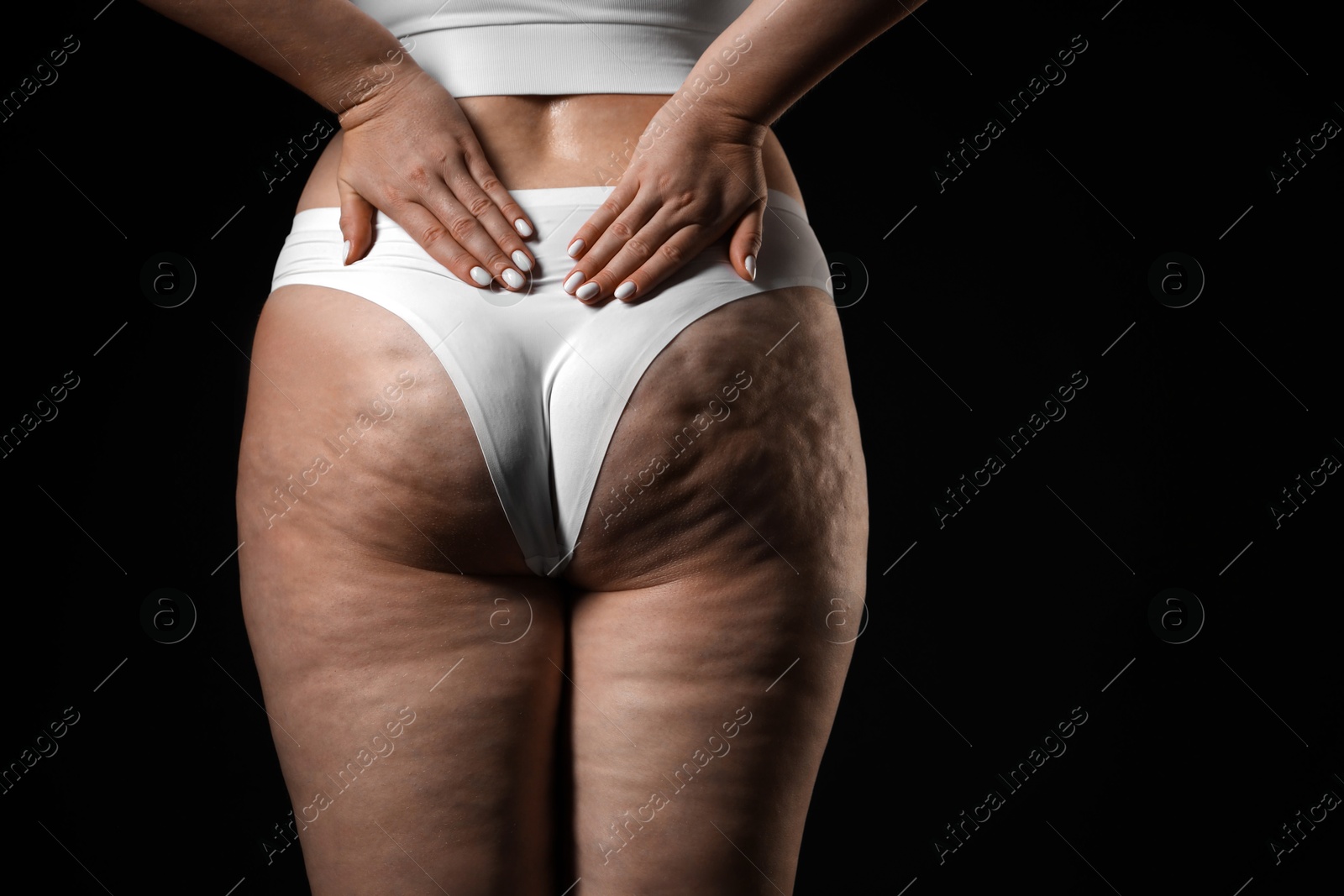 Photo of Woman with cellulite on black background, closeup. Space for text