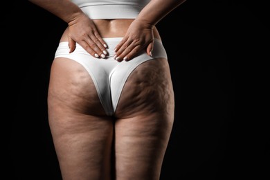 Woman with cellulite on black background, closeup. Space for text