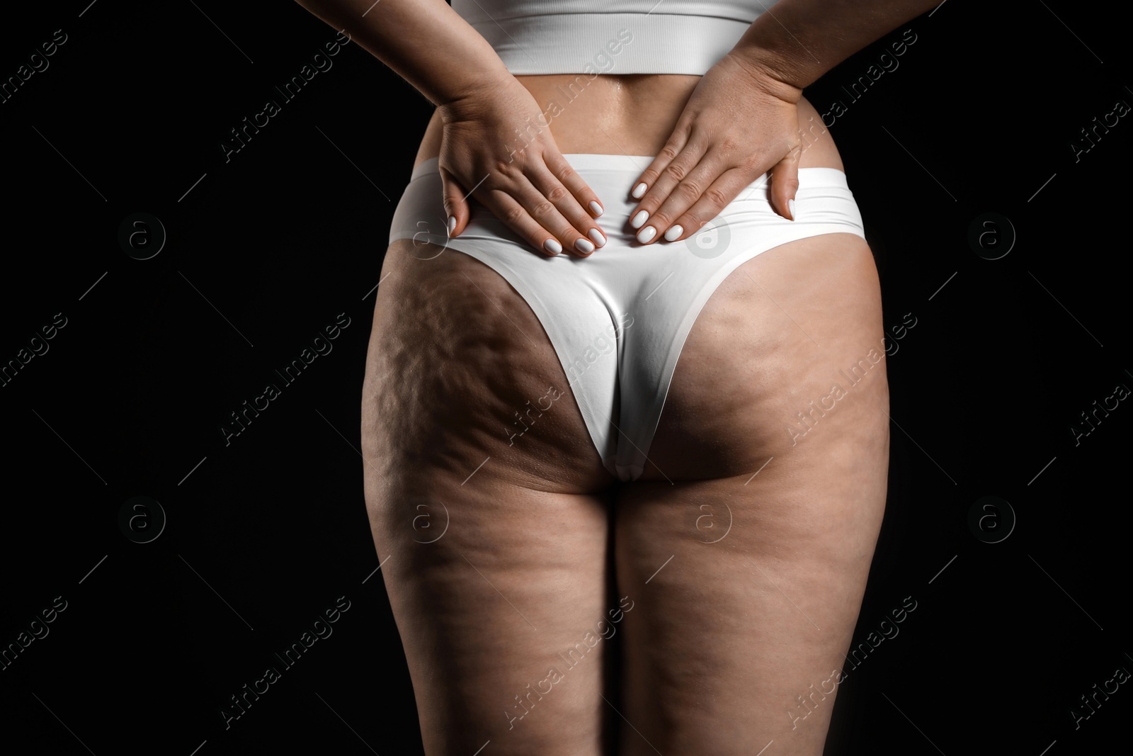 Photo of Woman with cellulite on black background, closeup