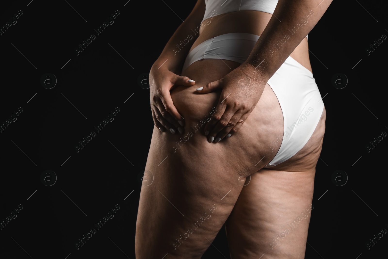 Photo of Woman with cellulite on black background, closeup. Space for text