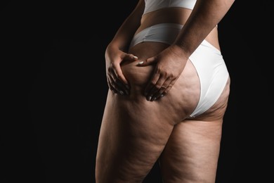 Woman with cellulite on black background, closeup. Space for text