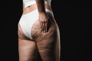 Woman with cellulite on black background, closeup. Space for text