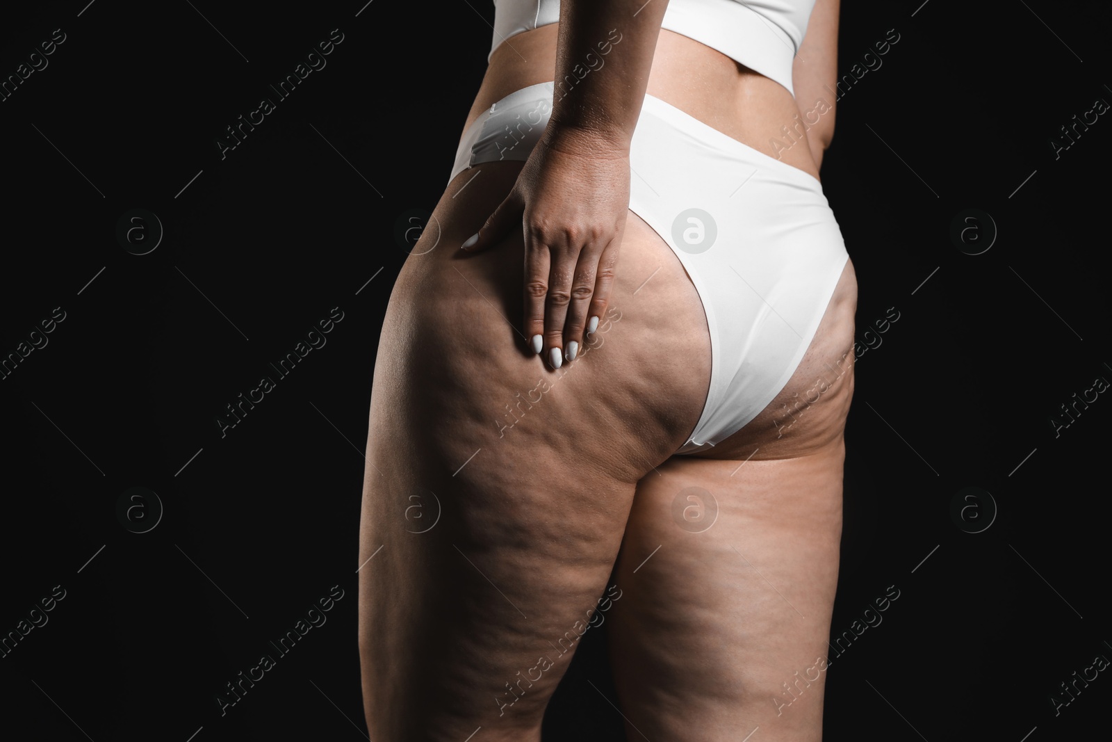 Photo of Woman with cellulite on black background, closeup