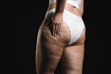 Woman with cellulite on black background, closeup