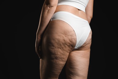 Woman with cellulite on black background, closeup