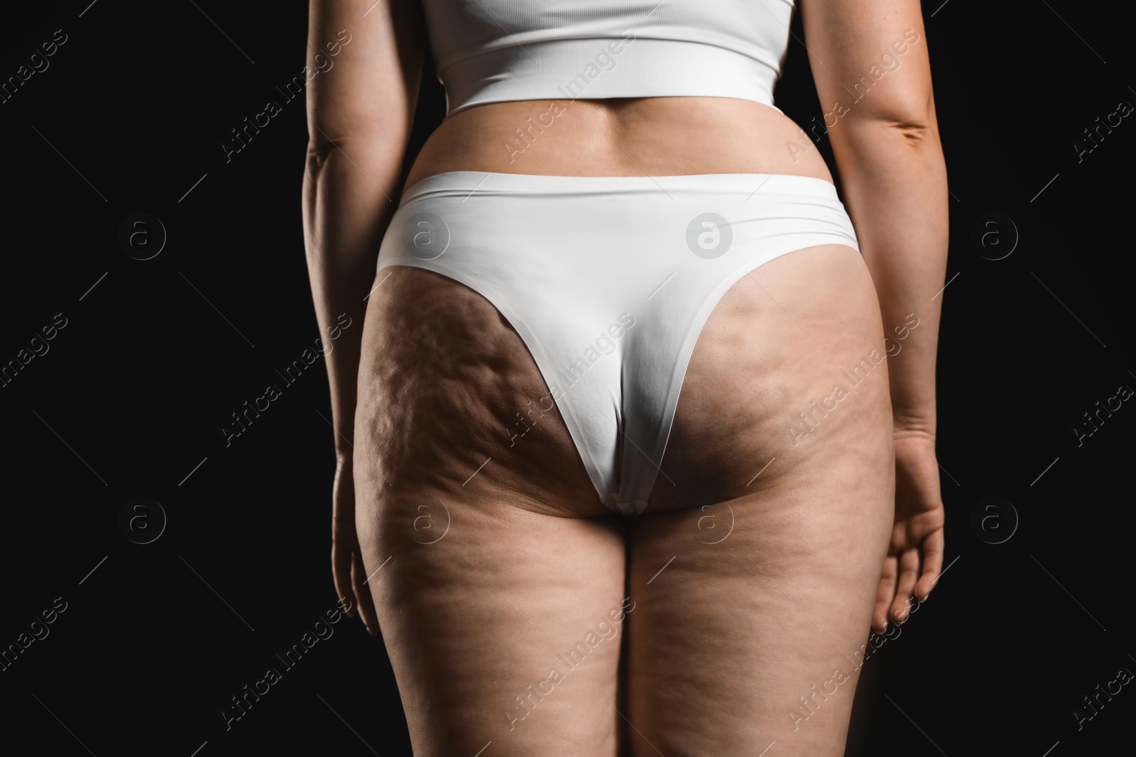 Photo of Woman with cellulite on black background, closeup