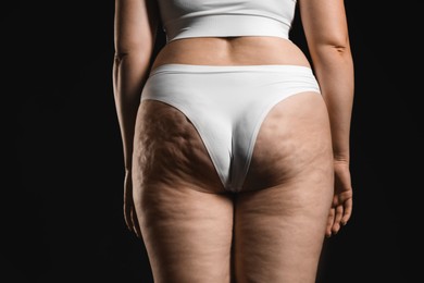 Photo of Woman with cellulite on black background, closeup