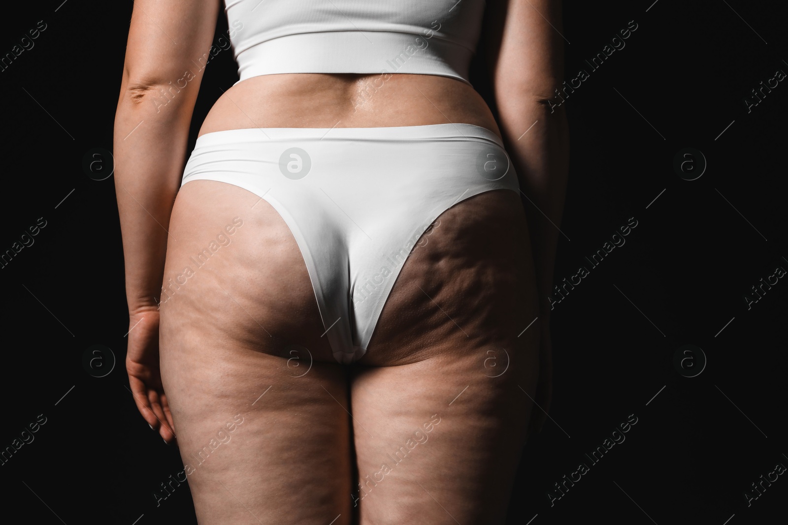 Photo of Woman with cellulite on black background, closeup