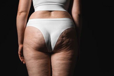 Woman with cellulite on black background, closeup