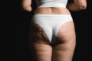 Photo of Woman with cellulite on black background, closeup