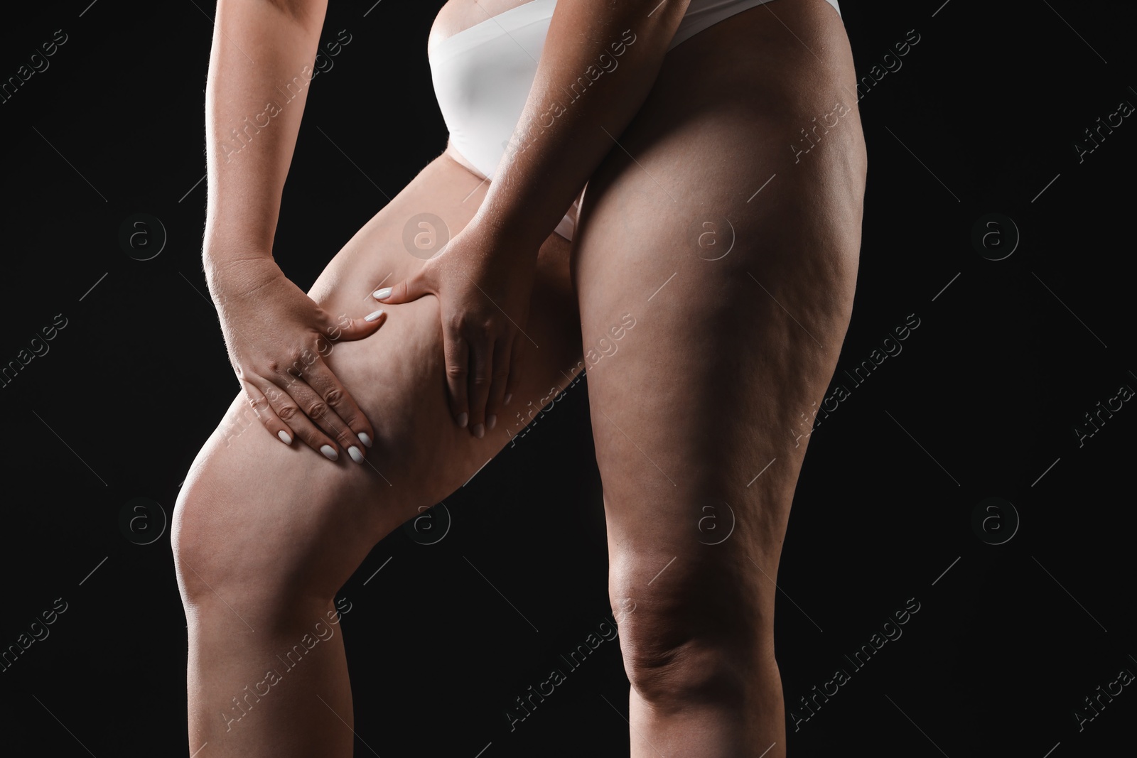 Photo of Woman with cellulite on black background, closeup