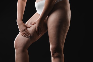 Photo of Woman with cellulite on black background, closeup