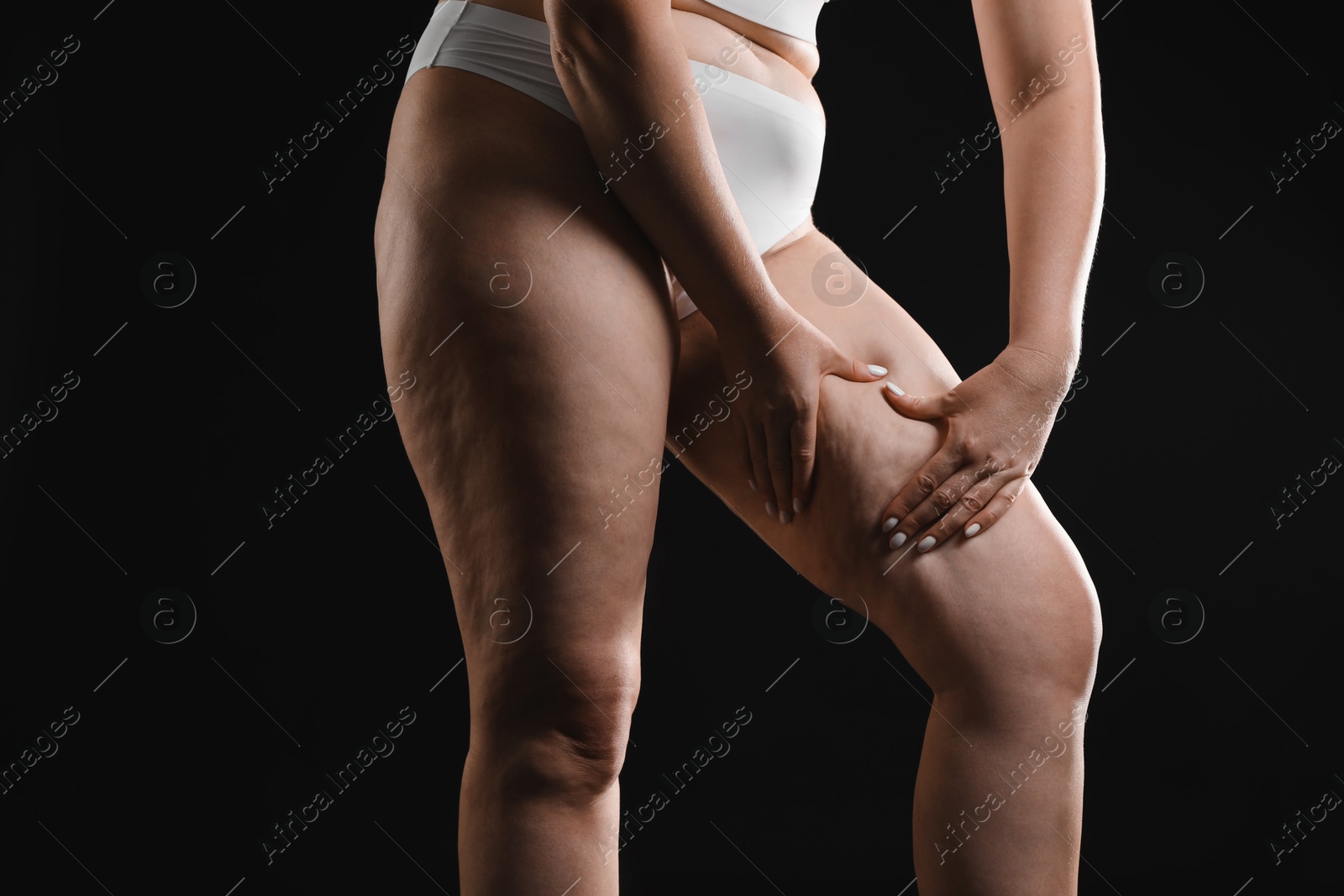 Photo of Woman with cellulite on black background, closeup