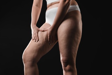 Woman with cellulite on black background, closeup