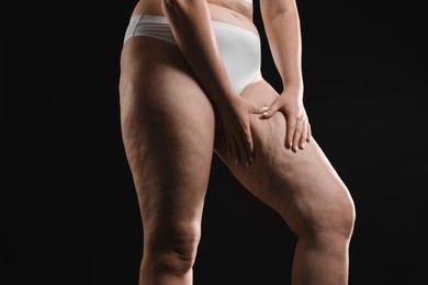 Photo of Woman with cellulite on black background, closeup