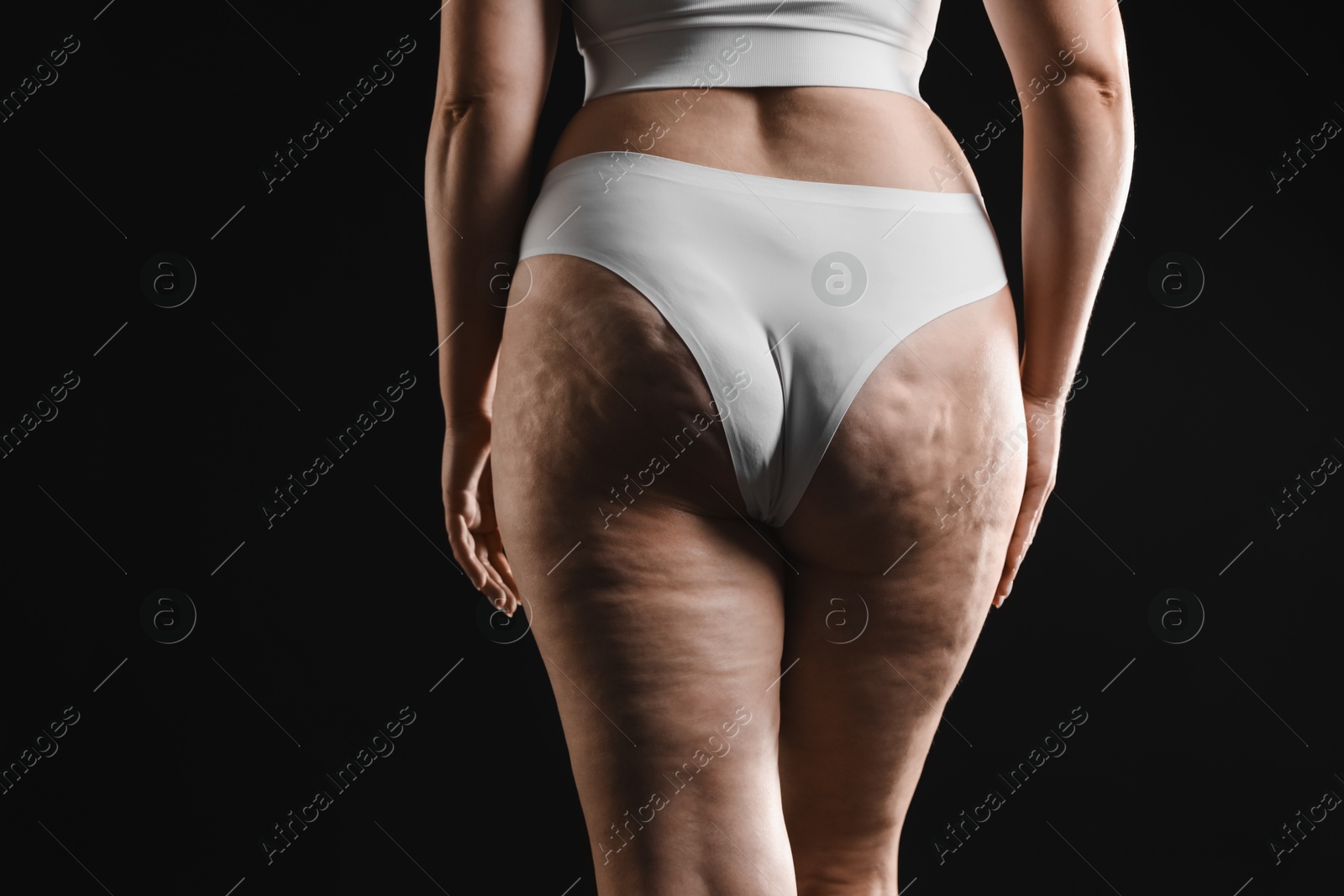 Photo of Woman with cellulite on black background, closeup