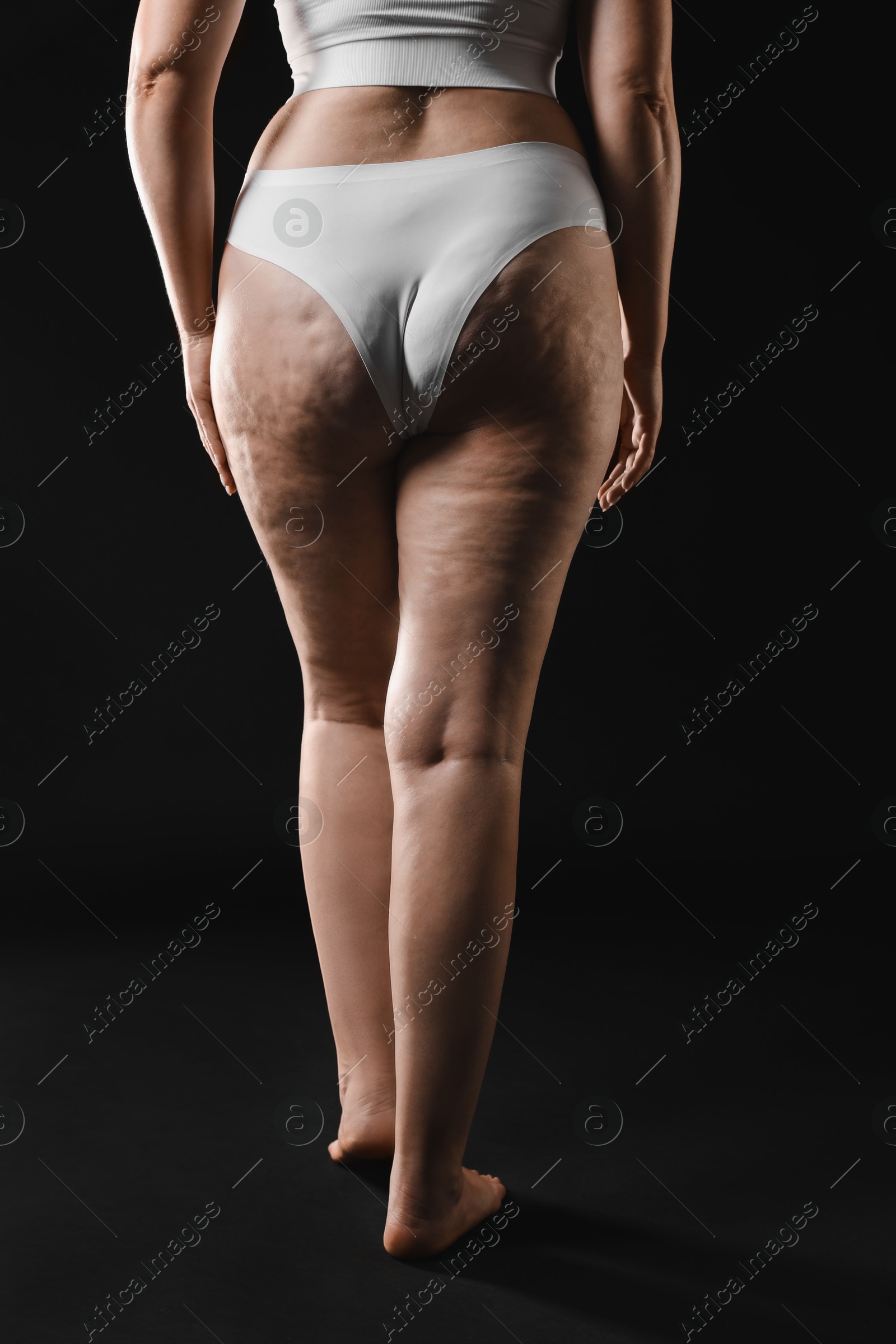 Photo of Woman with cellulite on black background, closeup