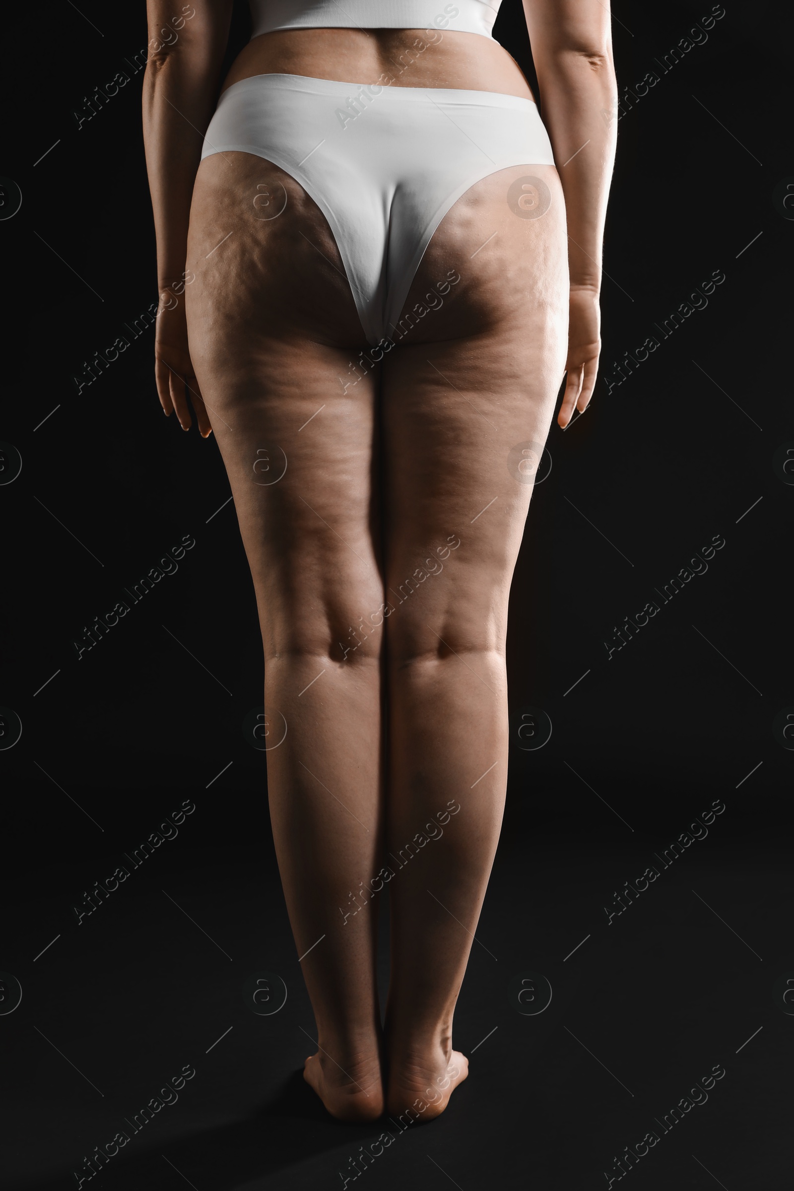 Photo of Woman with cellulite on black background, closeup