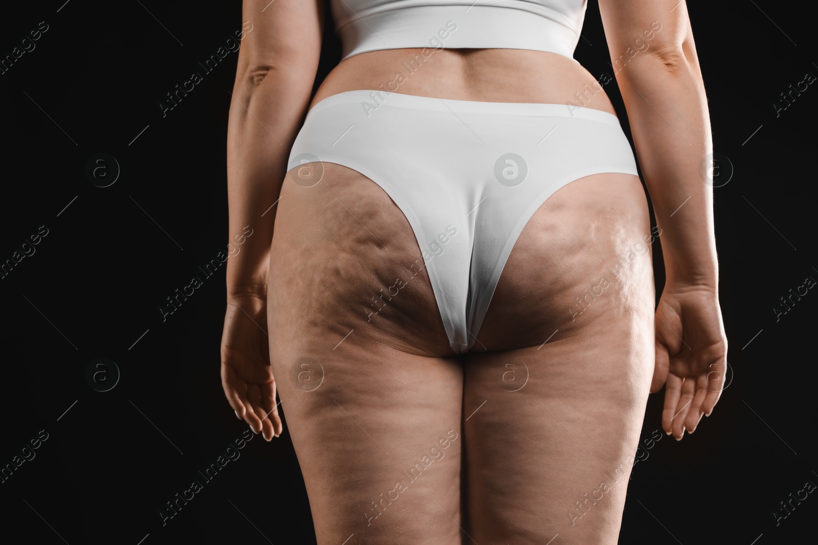 Photo of Woman with cellulite on black background, closeup