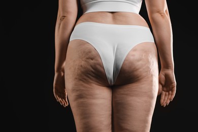 Woman with cellulite on black background, closeup