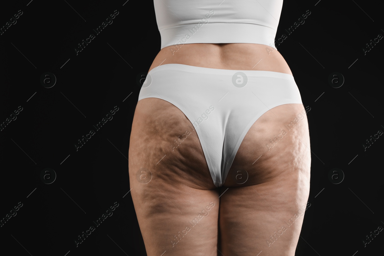 Photo of Woman with cellulite on black background, closeup