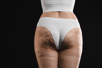 Photo of Woman with cellulite on black background, closeup