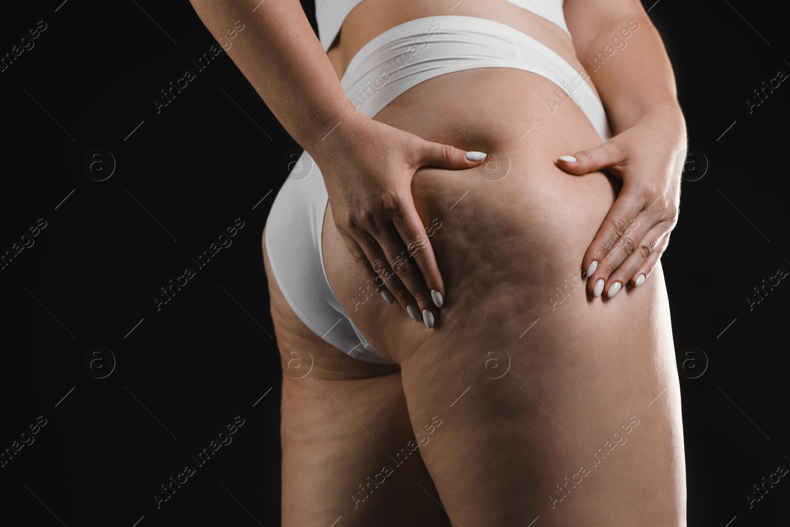 Photo of Woman with cellulite on black background, closeup. Space for text