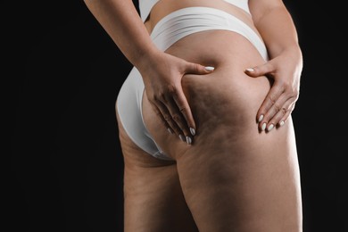 Woman with cellulite on black background, closeup. Space for text