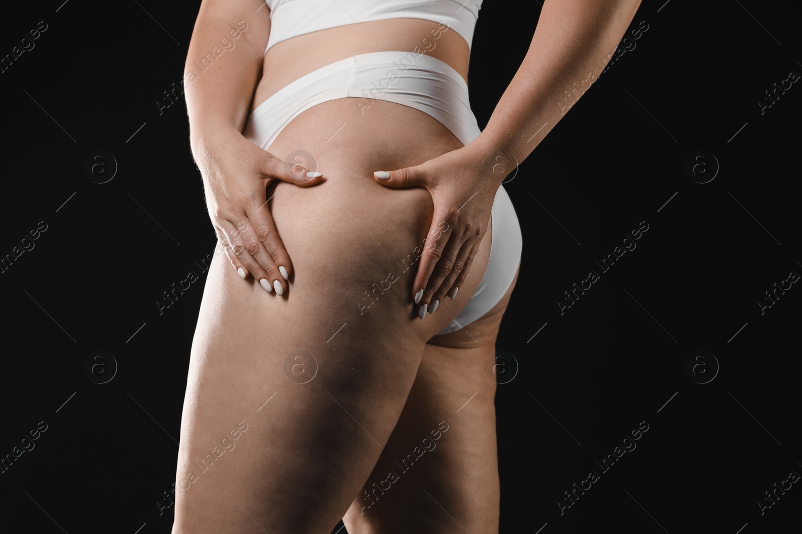 Photo of Woman with cellulite on black background, closeup. Space for text