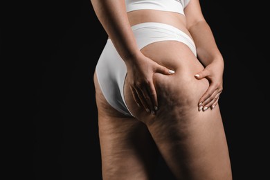 Woman with cellulite on black background, closeup. Space for text