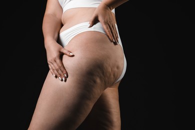 Photo of Woman with cellulite on black background, closeup. Space for text