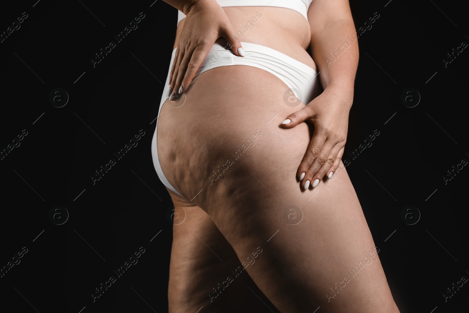 Photo of Woman with cellulite on black background, closeup