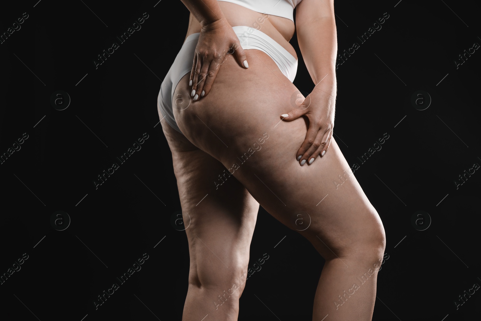 Photo of Woman with cellulite on black background, closeup