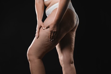 Woman with cellulite on black background, closeup