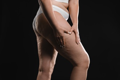 Woman with cellulite on black background, closeup